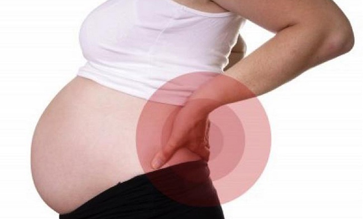 Em bé phát triển quá lớn trong bụng mẹ cũng làm ảnh hưởng đến hệ xương, gây thoát vị đĩa đệm