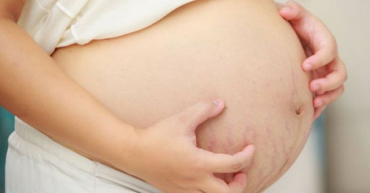 Phụ nữ có thai có nguy cơ bị bệnh cao hơn người bình thường