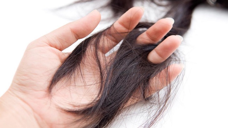 Rụng tóc nhiều là dấu hiệu của thận yếu ở phụ nữ