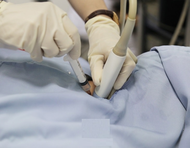 Người bệnh có thể được phẫu thuật cắt chóp nang để điều trị