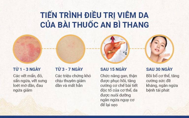 Tiến trình cải thiện bệnh viêm da với bài thuốc An Bì Thang