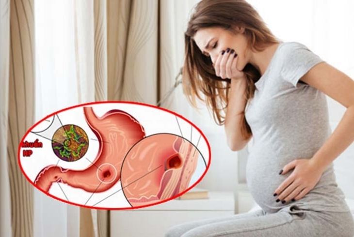 Thuốc đau dạ dày có ảnh hưởng tới thai nhi không được các bà bầu quan tâm.
