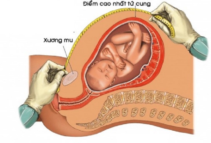 Cách đo bề cao tử cung để sác định sự phát triển của thai nhi