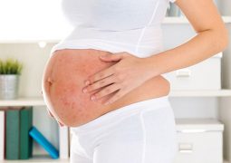 Bị vảy nến khi mang thai là tình trạng phổ biến thường gặp ở phụ nữ trong giai đoạn sinh sản