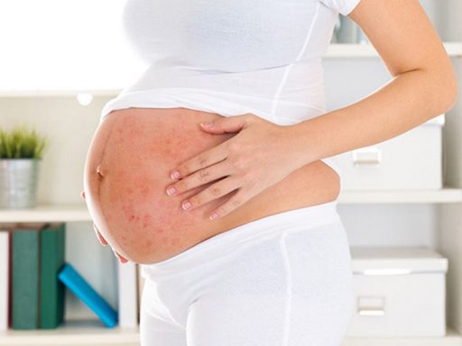 Bị vảy nến khi mang thai là tình trạng phổ biến thường gặp ở phụ nữ trong giai đoạn sinh sản