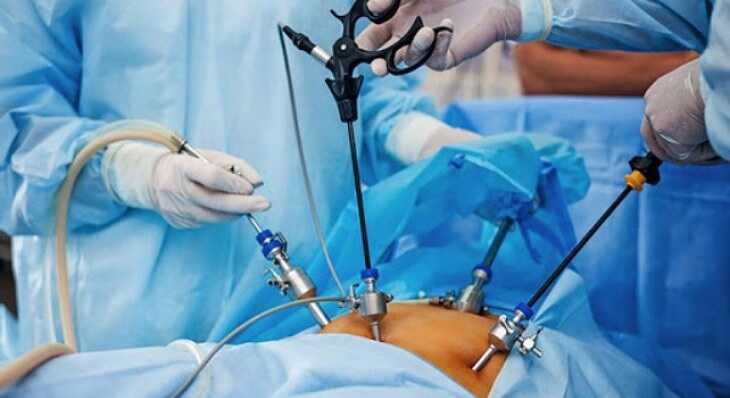 Phác đồ điều trị trào ngược dạ dày thực quản bằng cách phẫu thuật