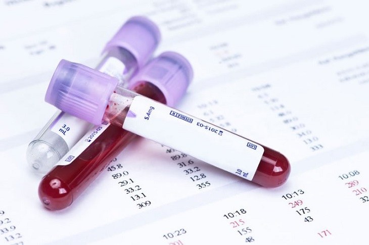 Xét nghiệm máu là phương pháp chẩn đoán mang đến tính chính xác cao