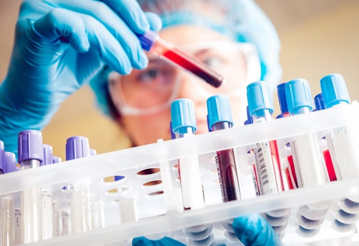 Xét nghiệm máu HP là 1 trong 4 phương pháp xét nghiệm phổ biến hiện nay