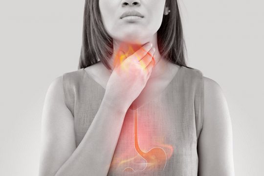 Viêm họng do trào ngược dạ dày thực quản là nguyên nhân phổ biến, nhiều người bệnh gặp phải