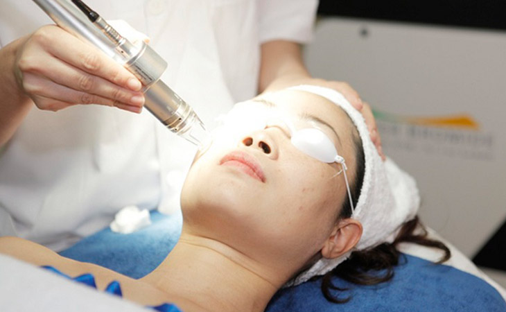 Công nghệ laser hiện đại giúp cải thiện tàn nhang và mang đến làn da khoẻ mạnh
