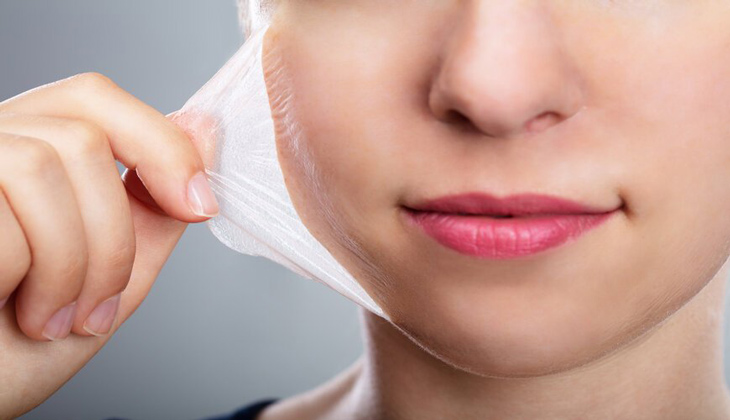 Peeling da cải thiện làn da mụn hiệu quả