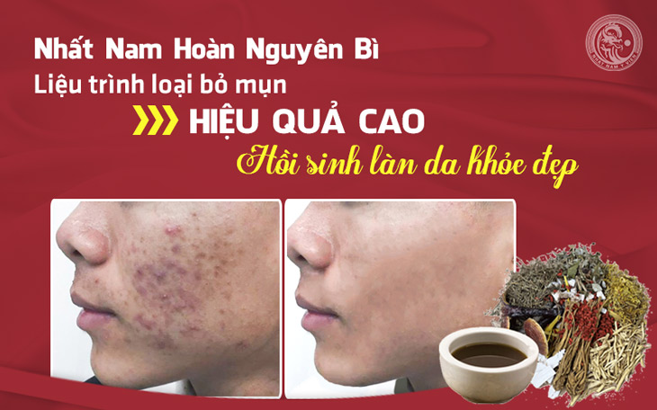 Làn da của bạn Hà Minh Tuấn sau 4 tháng dùng liệu trình xử lý mụn Nhất Nam Hoàn Nguyên Bì