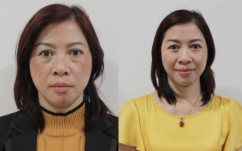 Cô Kim Hoa, khách hàng 50 tuổi trước và sau khi dùng Vương Phi