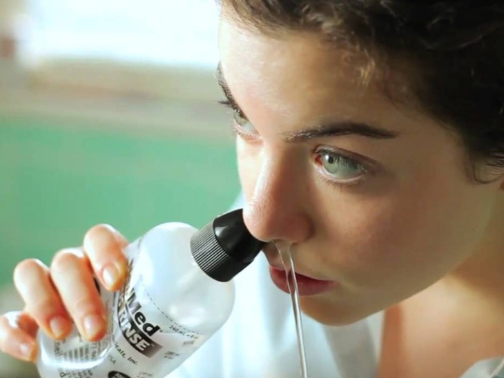 Sử dụng nước muối sinh lý để rửa mũi có thể phòng ngừa viêm xoang sàng hiệu quả