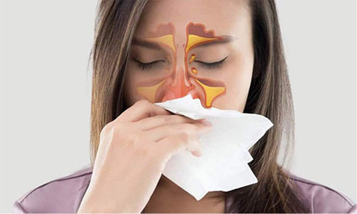 Viêm mũi dị ứng cũng là một trong nhiều nguyên nhân gây bệnh
