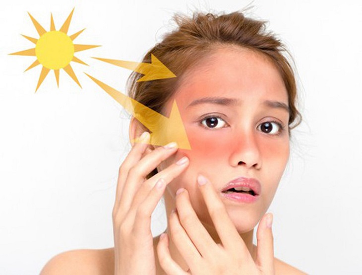 Bắt buộc phải dùng kem chống nắng để hạn chế tác động của ánh mặt trời tới làn da 