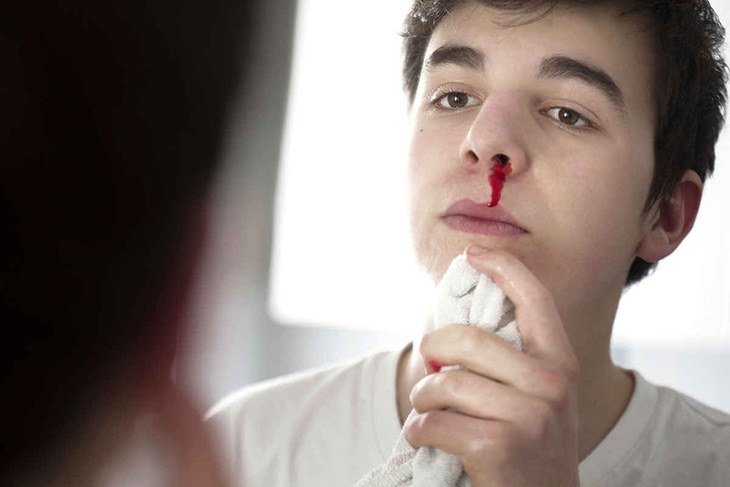 Người bệnh có thể bị chảy máu mũi thường xuyên
