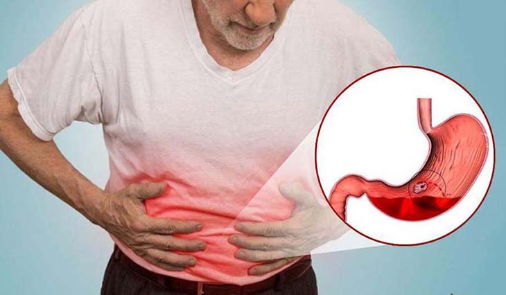Viêm hang vị dạ dày khiến người bệnh gặp những cơn đau bụng khó chịu