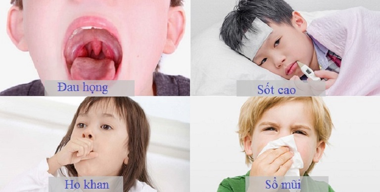 Có nhiều nguyên nhân khác nhau gây bệnh viêm họng