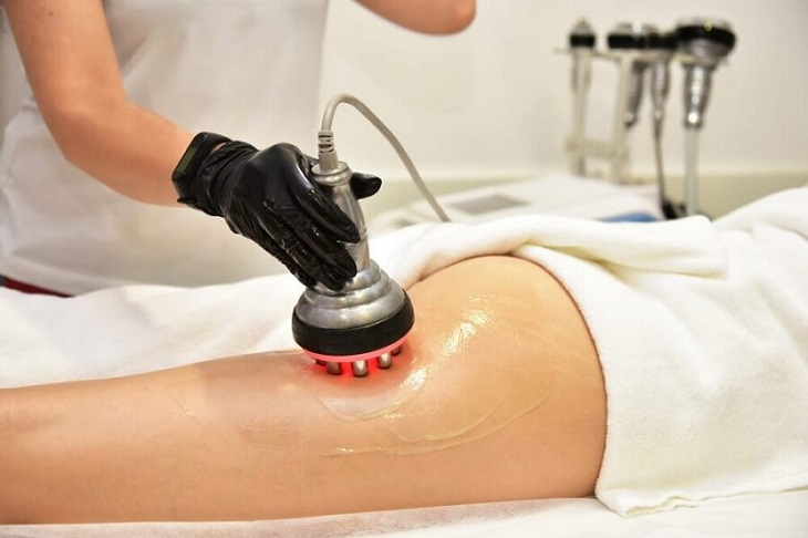 Bắn laser trị viêm nang lông là phương pháp hiện đại được nhiều người lựa chọn