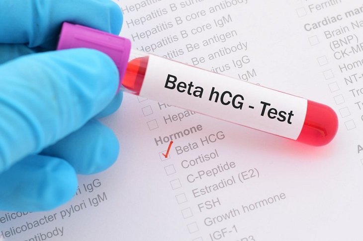 Xét nghiệm beta HCG trong máu, nước tiểu sẽ giúp xác định nguyên nhân
