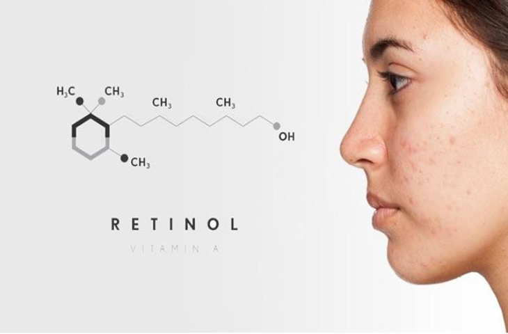 Retinol được nghiên cứu là có khả năng điều trị mụn
