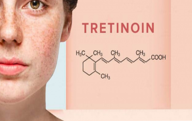 Tretinoin mang tới nhiều công dụng tốt cho làn da người dùng