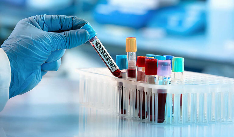 Xét nghiệm máu được áp dụng khá phổ biến trong quá trình chẩn đoán bệnh