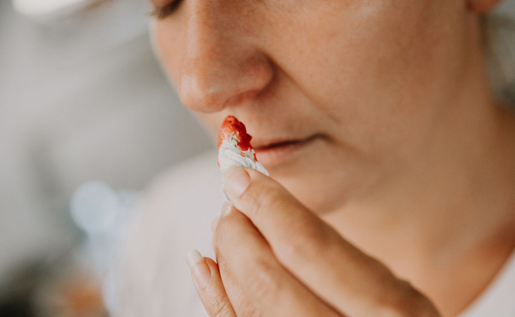 Chảy máu mũi khi bị viêm xoang là tình trạng khá phổ biến